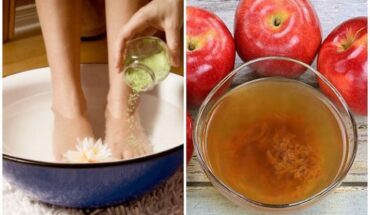Advantages of Vinegar That You Cannot Ignore