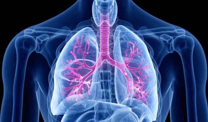 Deze alarmerende signalen van bronchitis moet je kennen!