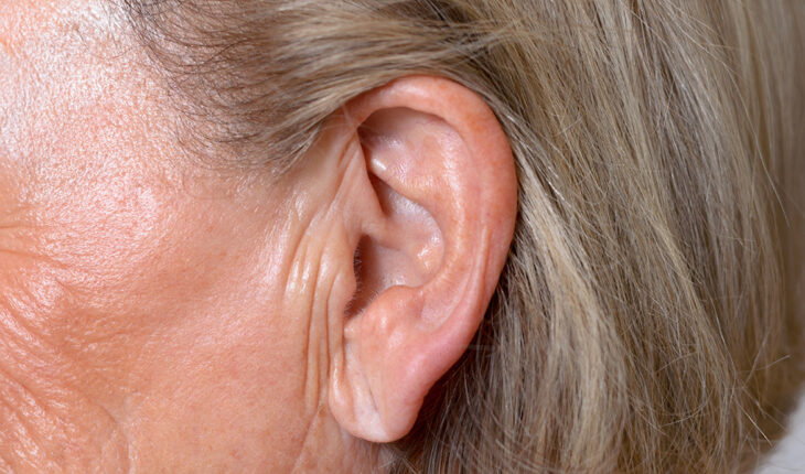 Do You Have a Fold in Your Earlobe? If So, Consult Your Doctor Today!