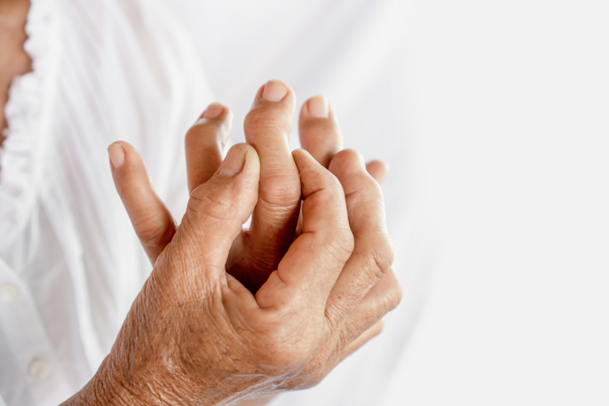 Asian female patient showing hand and fingers problem of gout, joint pain