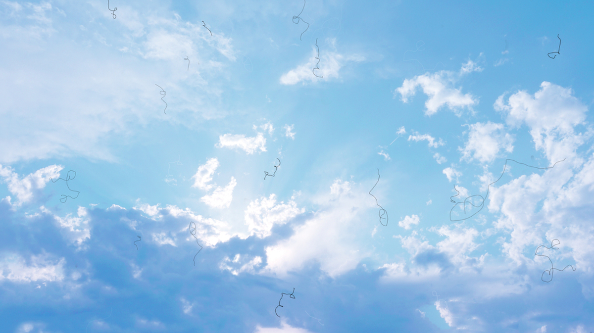 Myodesopsia eye Floaters Looking at the Sky