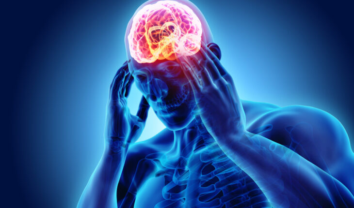 Migraine: Possible Causes, Symptoms & Treatment Options