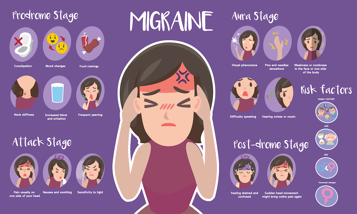 Cute infographic of Migraine and stages