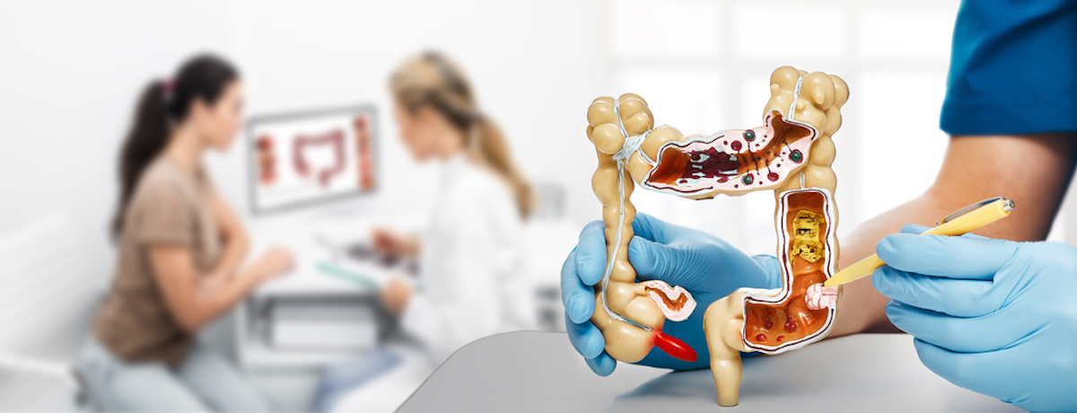 Treatment Cancer Colon Doctor Pointing Pen Tumor Intestines Using an Anatomical Model Consultation Gastroenterologist for a Patient over Background