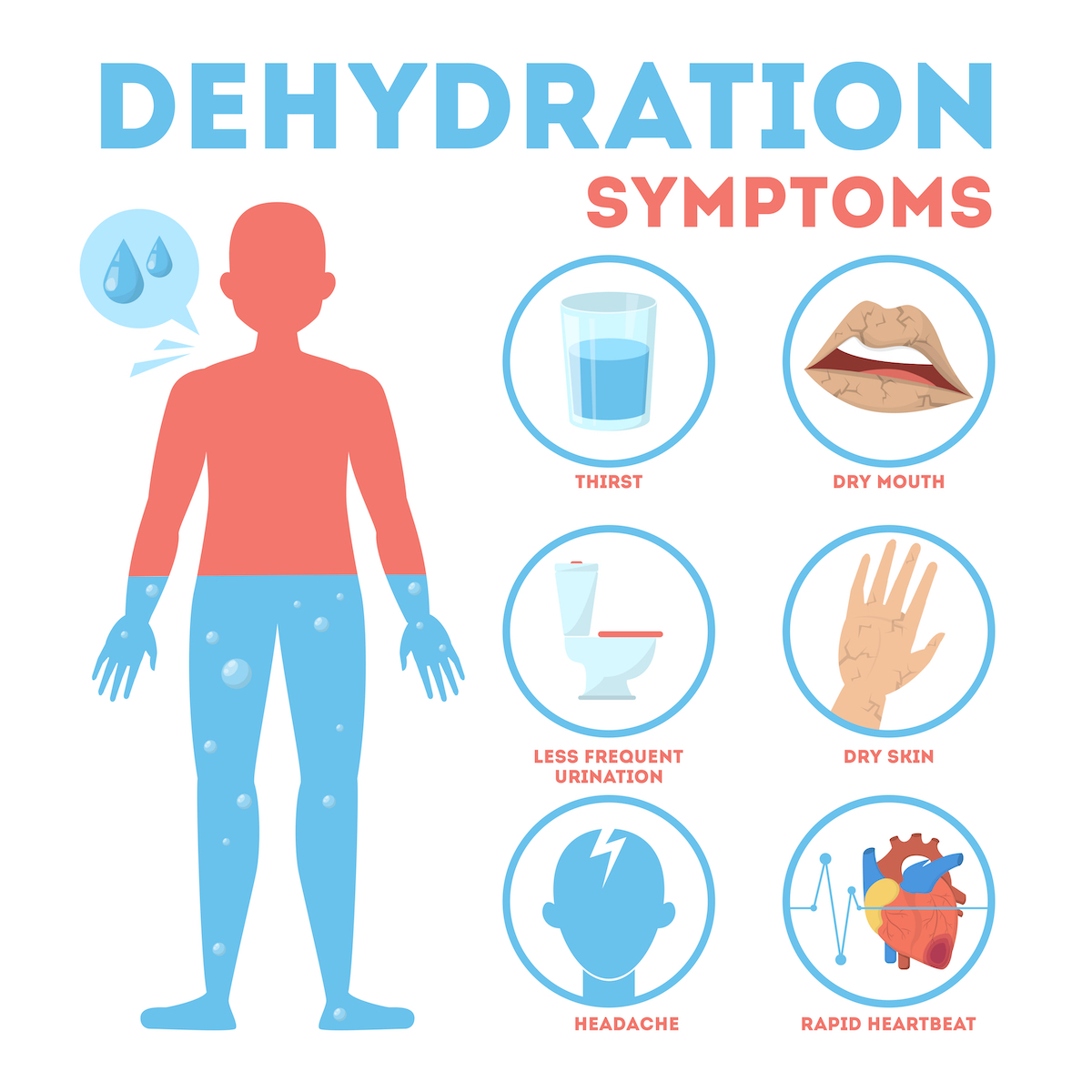 Infographic symptoms of dehydration. Dry mouth and feeling thirsty. The importance of drinking water. Isolated vector illustration in cartoon style. 