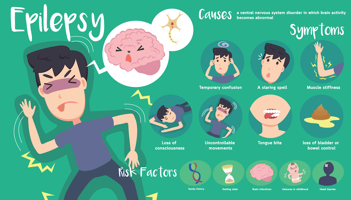 Epilepsy Causes Types Warning Signs And Treatment Options Page 2 Of 3 0913