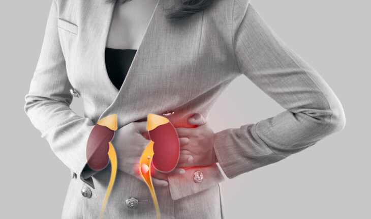 Kidney Stones: Causes, Symptoms & Treatment Options