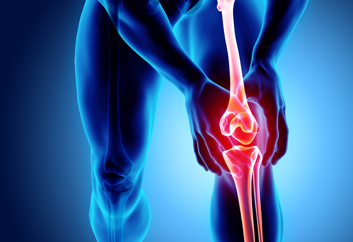 Knee sore - skeletal x-ray, 3D Illustration medical concept. Osteoarthritis