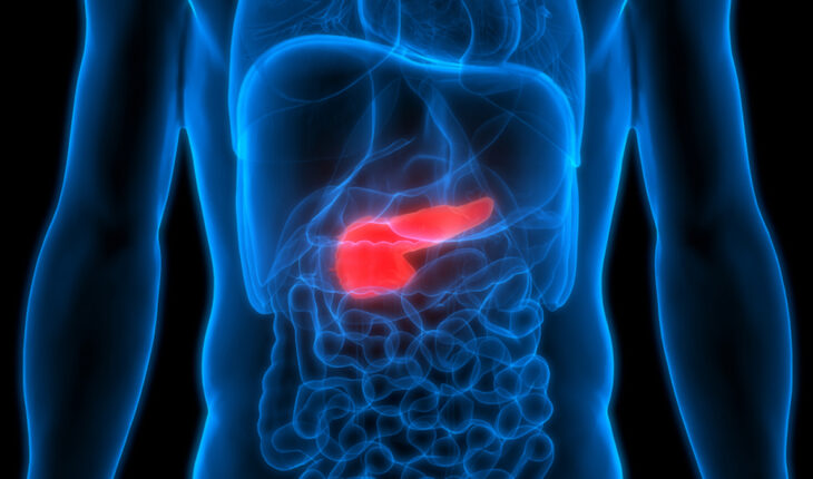 Pancreatitis: Causes, Symptoms & Treatment Options