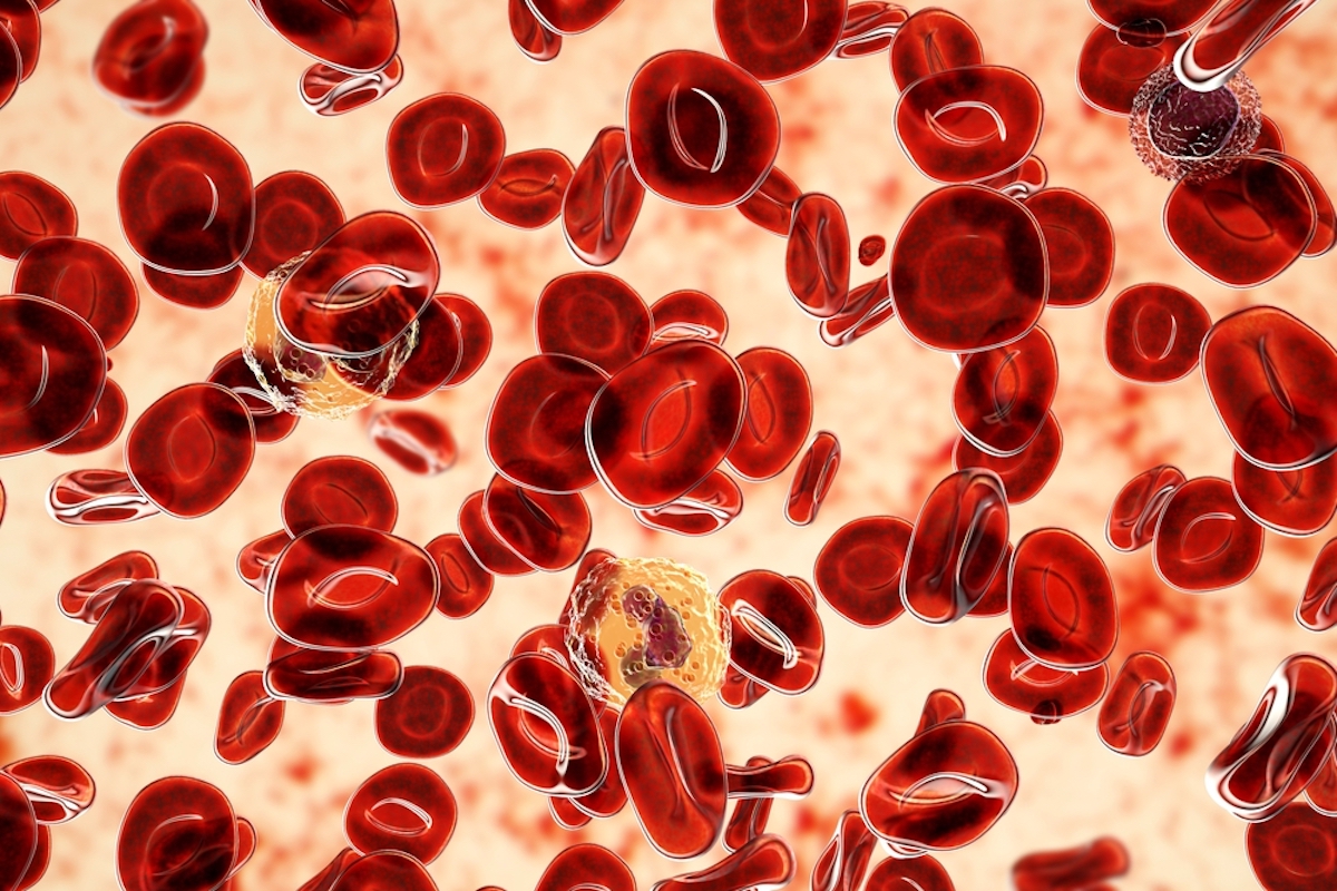 Polycythemia vera, a rare slow-growing blood cancer with an increase in the number of red blood cells in the body, 3D illustration showing abundant erythrocytes inside blood vessel 