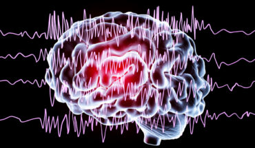 Epilepsy: Causes, Types, Warning Signs & Treatment Options