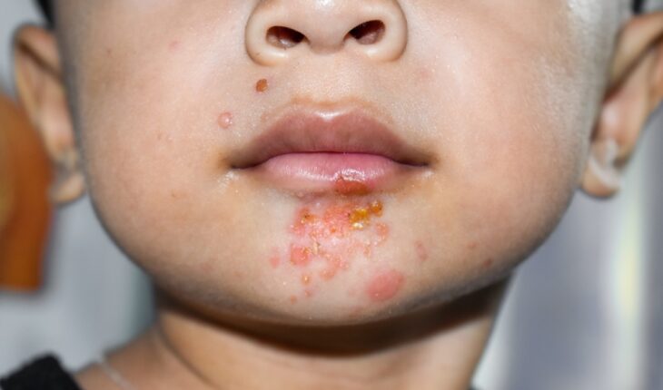 How To Identify Your Skin Rash & When To Seek Medical Treatment