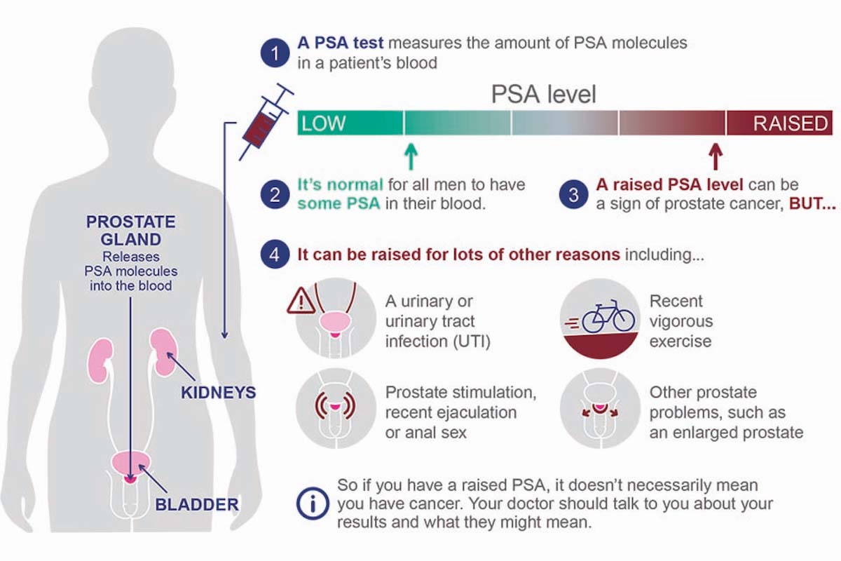 infographic about psa test