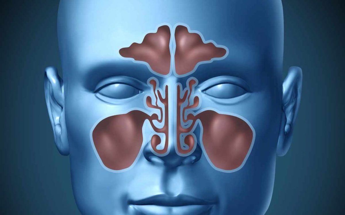 Nasal Sinus Infection Cured by Medicine. Frontal, Ethmoidal, Sphenoidal and Maxillary Sinuses. Sinusitis. 3D Illustration.