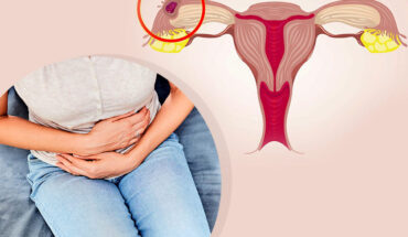 Everything You Should Know About Ectopic Pregnancies
