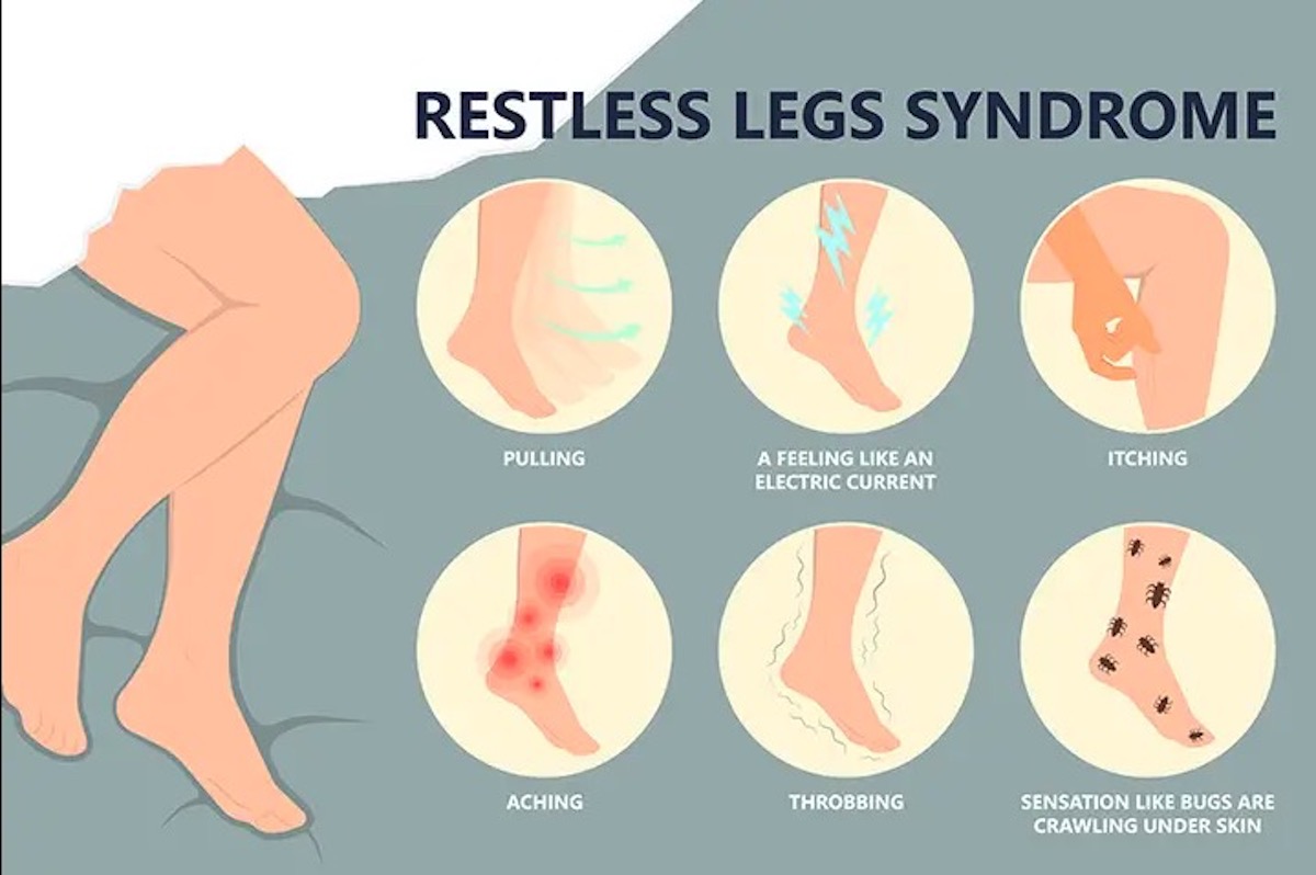 symptoms of restless legs syndrome