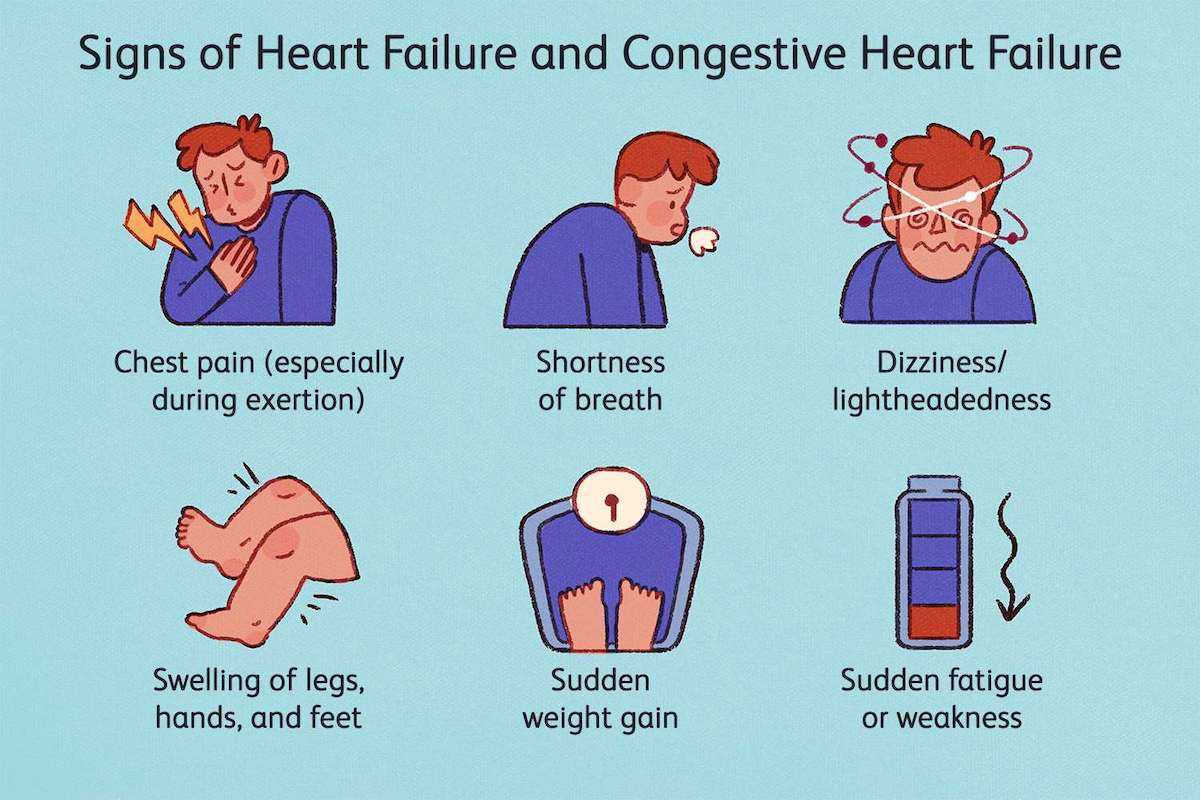 infographic about signs of heart failure and congestive heart failure