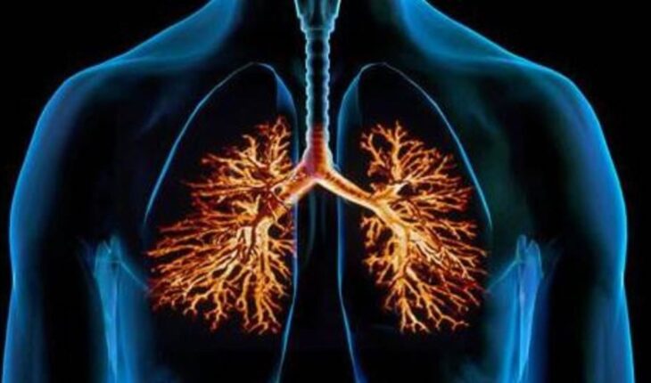 Bronchitis: Causes, Symptoms & When to See Your Doctor
