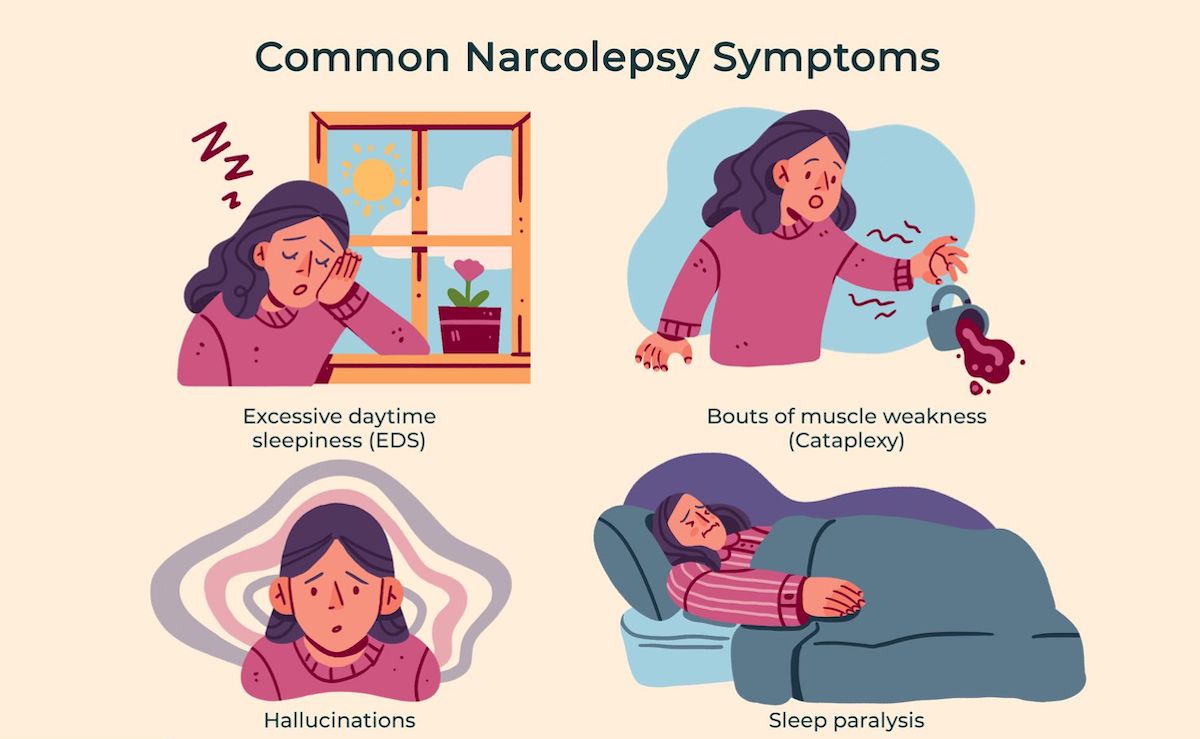 Common narcolepsy symptoms