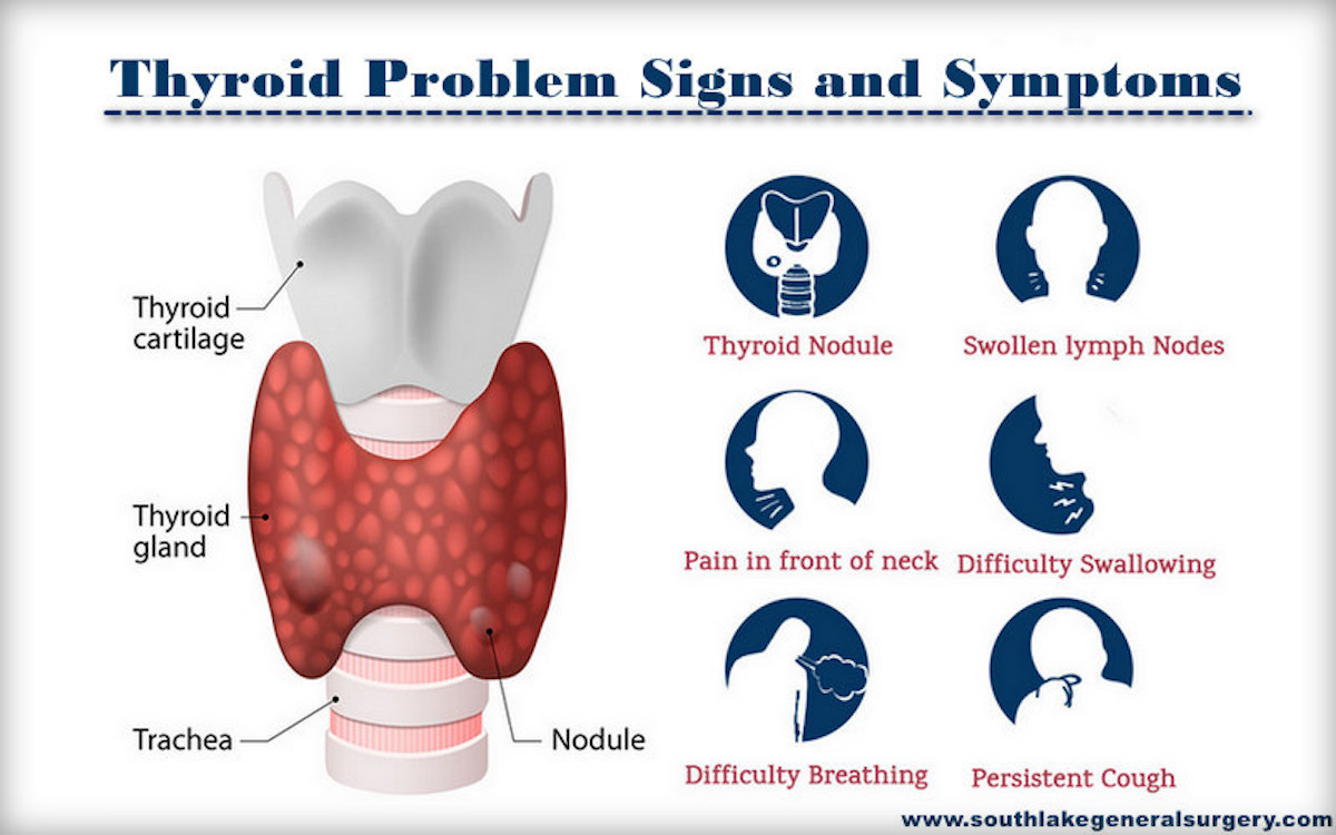 Thyroid Problems