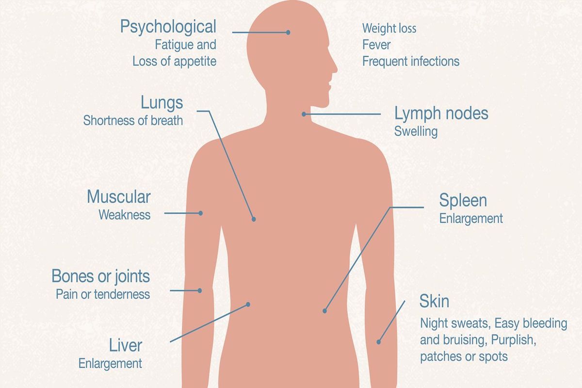 common symptoms of (chronic myeloid) leukemia