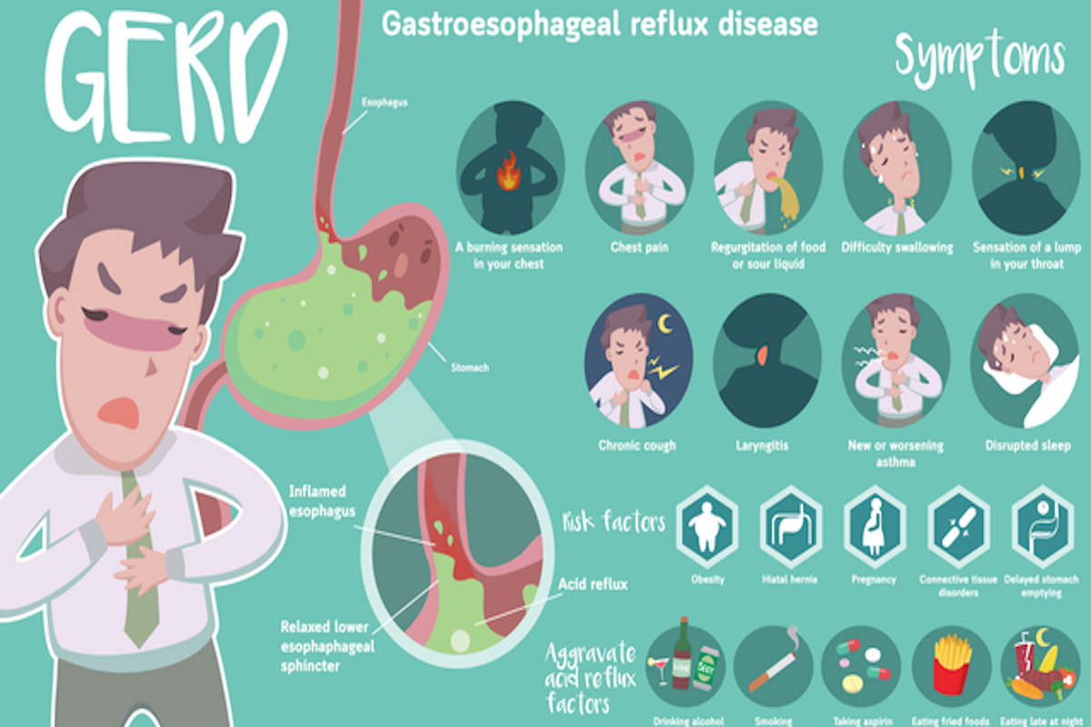 Gerd Symptoms