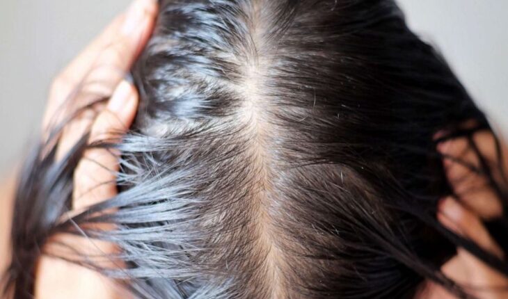 Hair Loss: Causes, Treatment Options & When to Visit Your Doctor