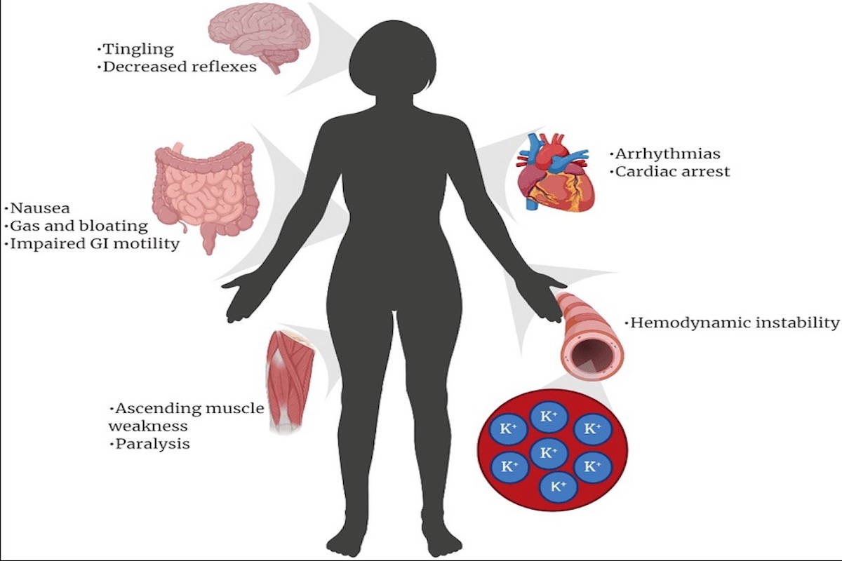 symptoms of hyperkalemia