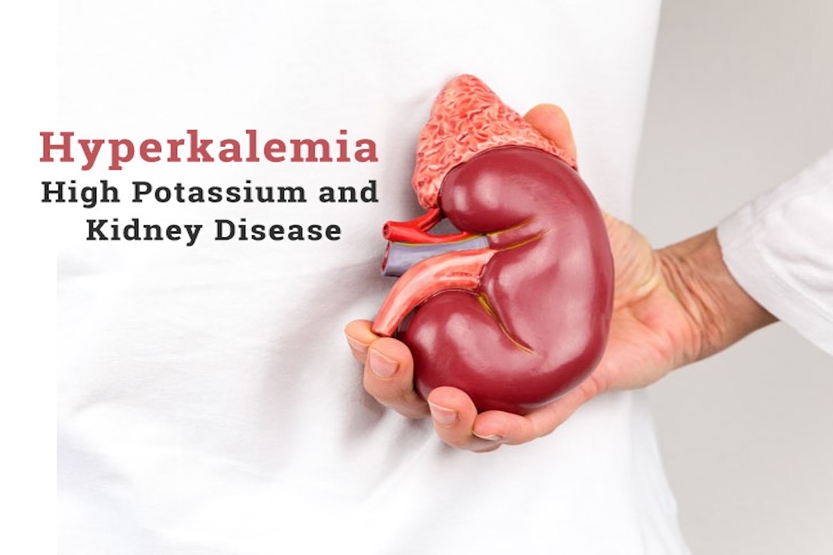 hyperkalemia