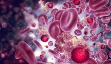 Plasma Cell Cancers: Types, Symptoms & Treatments