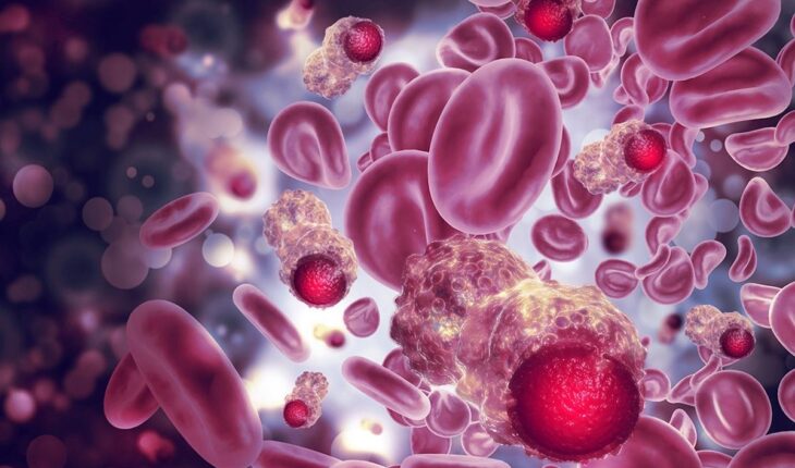 Plasma Cell Cancers: Types, Symptoms & Treatments