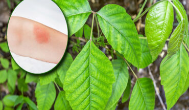 Plants that Give a Rash: How to Identify and Avoid Them