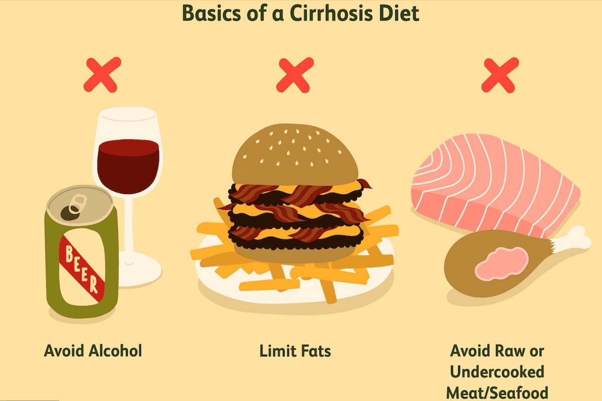 Liver cirrhosis diet