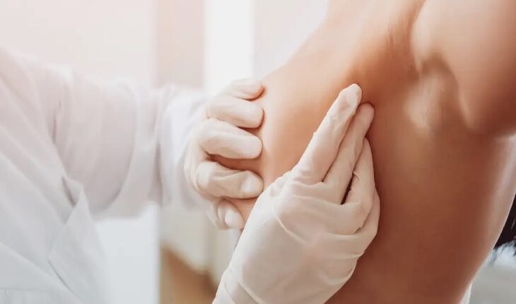 Breast Cancer: Causes, Symptoms, Stages & Treatment Options