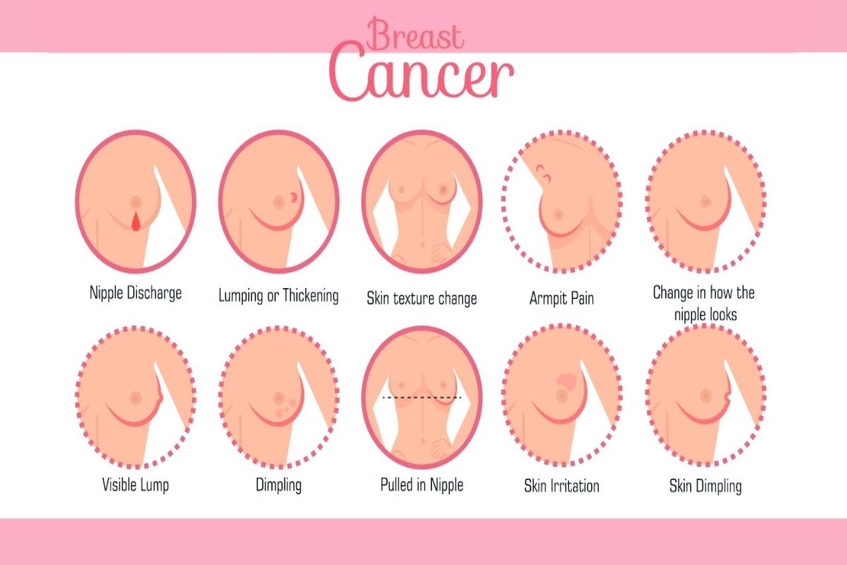 Breast Cancer Symptoms