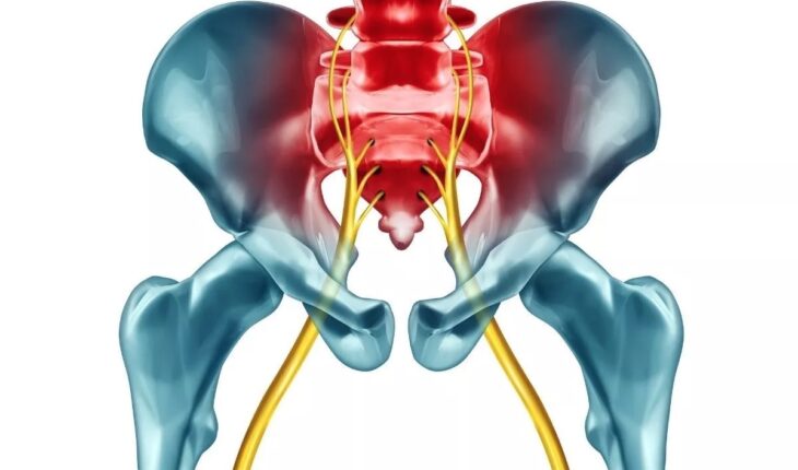 This Is What You Should Know About Sciatica