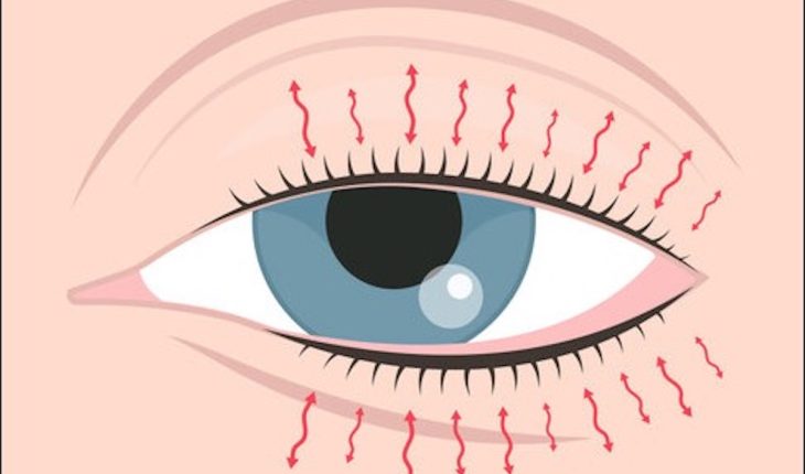 Eye Twitching: Causes, Symptoms & Treatment Options