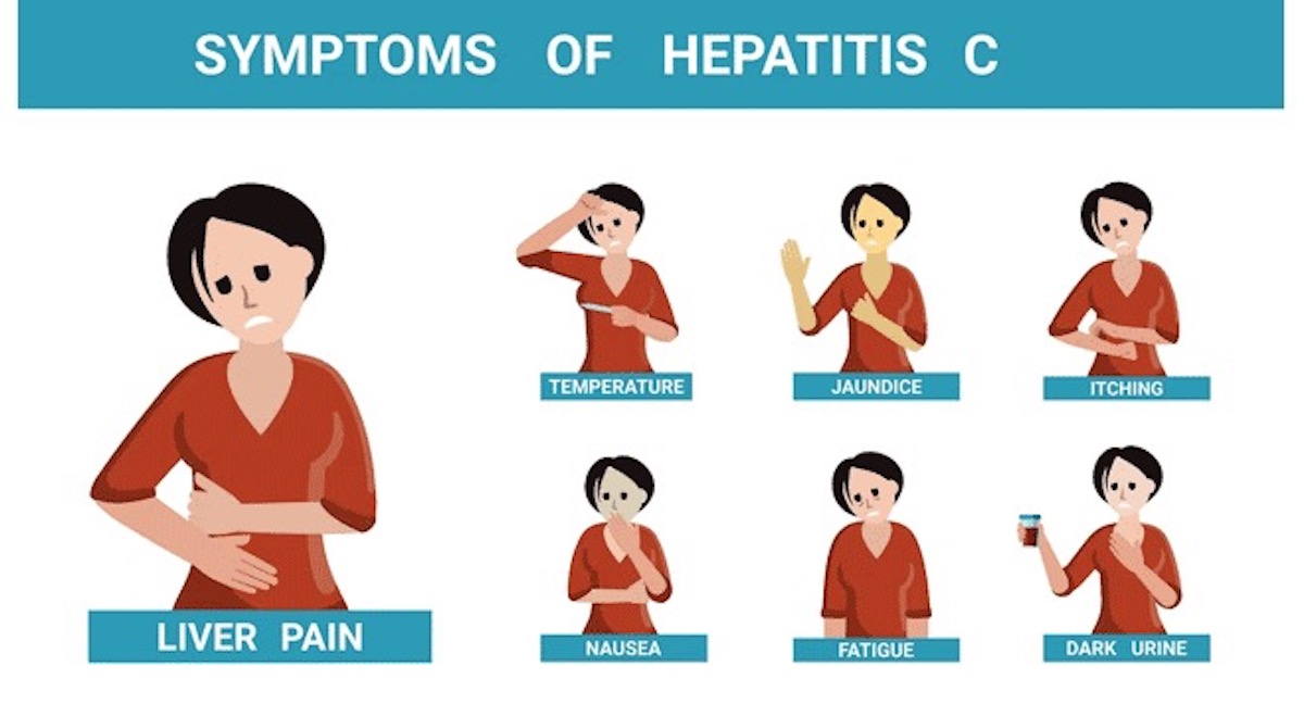 Hepatitis C Symptoms