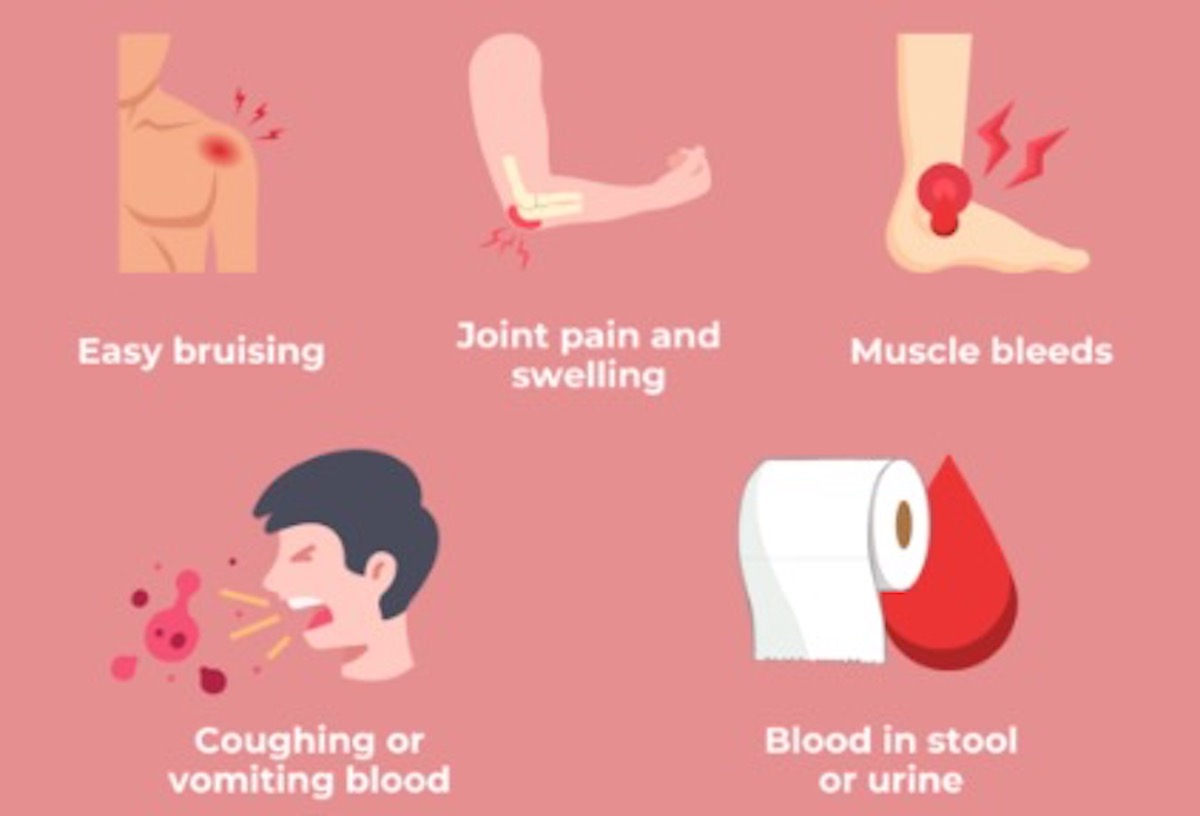 Hemophilia B Symptoms