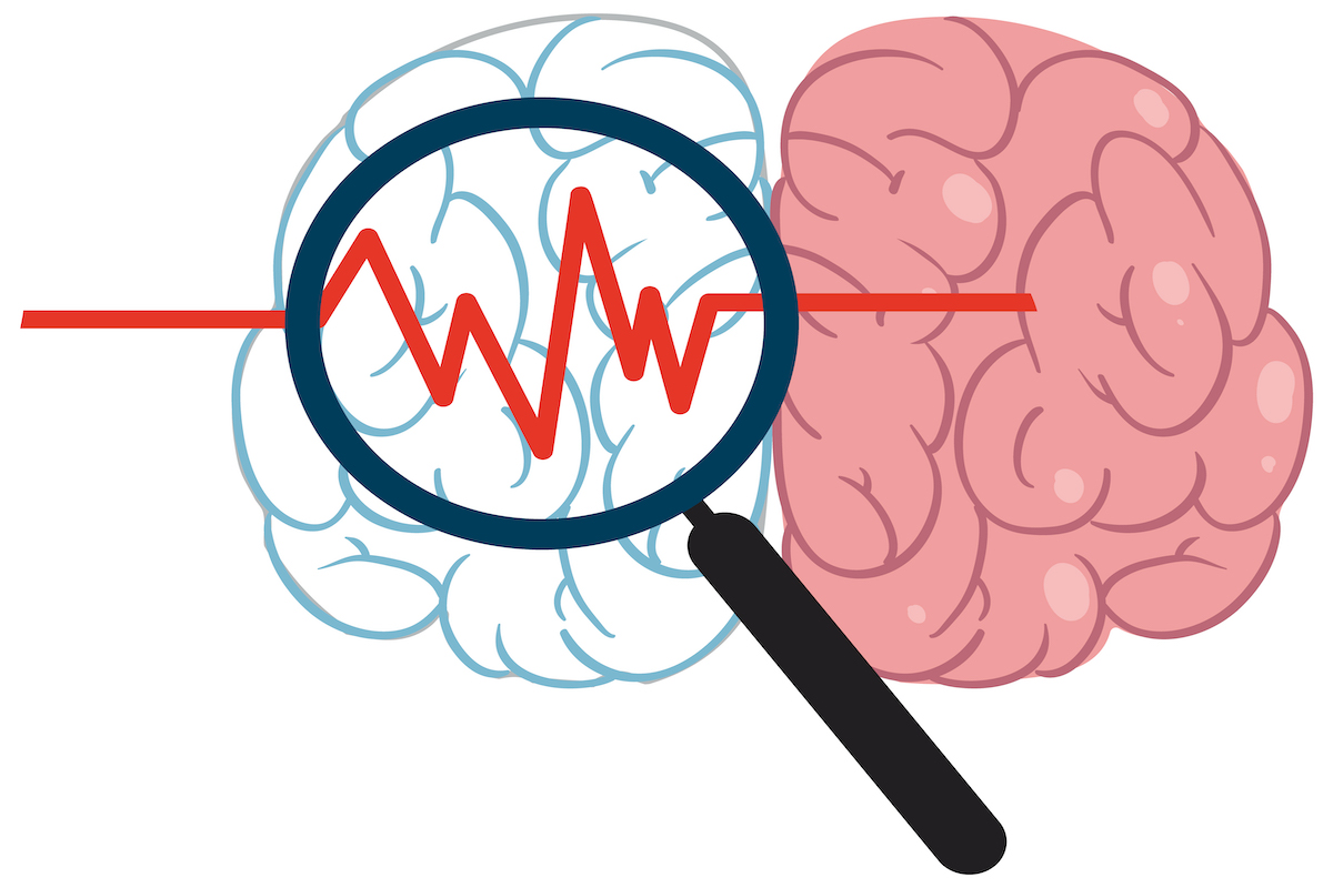 Pseudobulbar Affect Pba Symptoms